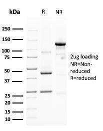 SDS-PAGE analysis of Anti-MUC4 Antibody [MUC4/3105] under non-reduced and reduced conditions; showing intact IgG and intact heavy and light chains, respectively. SDS-PAGE analysis confirms the integrity and purity of the antibody