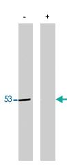 Anti-PPP2R2B Polyclonal Antibody