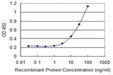 Anti-MARCH2 Mouse Monoclonal Antibody [clone: 7F3]