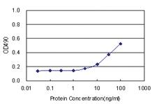 Anti-SERPINA6 Antibody Pair