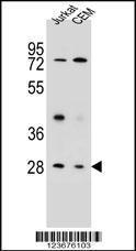 Anti-CD37 Rabbit Polyclonal Antibody