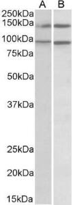 Anti-ARHGEF18 Antibody (A82796) (05 µg/ml) staining of lysates of cell lines Daudi (A) and Caco-2 (B) (35 µg protein in RIPA buffer) Primary incubation was 1 hour Detected by chemiluminescence