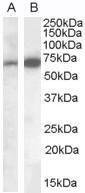 Staining of Human Brain (Cerebellum) lysate (35 µg protein in RIPA buffer). A) Anti-CADM4 Antibody (A84399) (0.1 µg/ml) and B) Anti-CADM4 Antibody (0.05 µg/ml). Detected by chemilu minescence