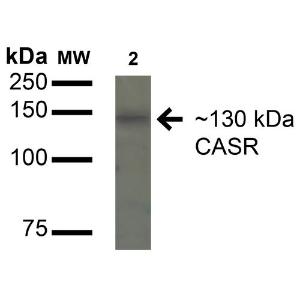 Anti-CaSR antibody