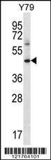 Anti-IFNGR1 Rabbit Polyclonal Antibody (AP (Alkaline Phosphatase))