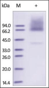 The purity of rh GPC3 / Glypican-3 was determined by DTT-reduced (+) SDS-PAGE and staining overnight with Coomassie Blue.