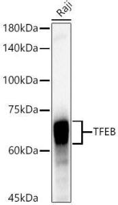 Western blot analysis of extracts of Raji cells, using Anti-TFEB Antibody [ARC53777] (A308944) at 1:2,000 dilution. The secondary Antibody was Goat Anti-Rabbit IgG H&L Antibody (HRP) at 1:10000 dilution. Lysates/proteins were present at 25 µg per lane