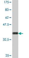 Anti-IFT122 Mouse Polyclonal Antibody