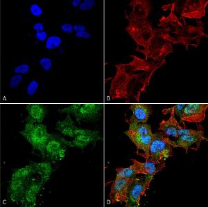 Anti-CaSR antibody