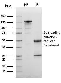 Anti-C3d antibody