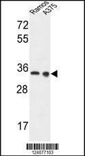 Anti-LDHA Rabbit Polyclonal Antibody (APC (Allophycocyanin))