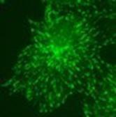 KT36 immunofluorescent staining for EB3 over expressed COS7 cells. Courtesy of Dr. Anna Akhmanova.