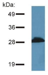 Detection of PRR7 / TRAP3 in murine brain lysate by Western blotting using Anti-PRR7 Antibody (A85830)