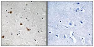 Immunohistochemical analysis of paraffin-embedded human brain using Anti-IKK-gamma (phospho Ser376) Antibody. The right hand panel represents a negative control, where the Antibody was pre-incubated with the immunising peptide