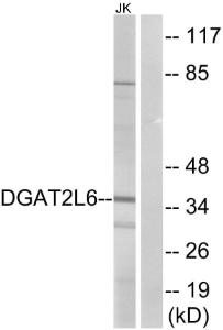 Western blot analysis of lysates from Jurkat cells using Anti-DGAT2L6 Antibody The right hand lane represents a negative control, where the antibody is blocked by the immunising peptide