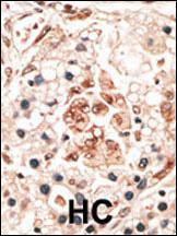 Anti-HPCA Rabbit Polyclonal Antibody (Biotin)