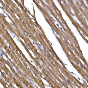 Immunohistochemistry analysis of paraffin-embedded rat heart using Anti-PPP1R3C Antibody (A307722) at a dilution of 1:50 (40X lens). Perform high pressure antigen retrieval with 10 mM citrate buffer pH 6.0 before commencing with IHC staining protocol