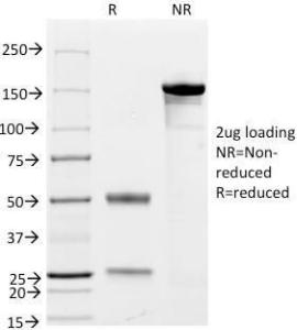 SDS-PAGE analysis of Anti-CD79a Antibody [JCB117 + HM47/A9] under non-reduced and reduced conditions; showing intact IgG and intact heavy and light chains, respectively SDS-PAGE analysis confirms the integrity and purity of the antibody