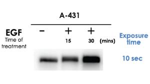 Anti-EGFR Rabbit Polyclonal Antibody