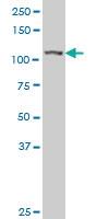 Anti-MTHFD1L Mouse Polyclonal Antibody