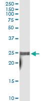 Anti-TAF10 Polyclonal Antibody Pair