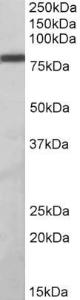 Anti-ZBTB24 Antibody (A82798) (1 µg/ml) staining of Daudi lysate (35 µg protein in RIPA buffer). Primary incubation was 1 hour. Detected by chemiluminescence