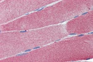 Anti-CADM4 Antibody (A84399) (2.5 µg/ml) staining of paraffin embedded Human Skeletal Muscle. Steamed antigen retrieval with citrate buffer pH 6, AP-staining