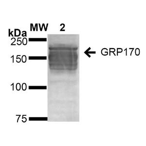 Western blot analysis of human Embryonic kidney epithelial cell line (HEK293