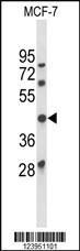 Anti-FLT3 Rabbit Polyclonal Antibody