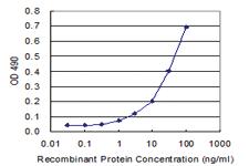 Anti-PDE4DIP Polyclonal Antibody Pair