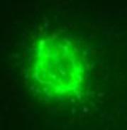 KT36 immunofluorescent staining for cell mitosis. Courtesy of Dr. Anna Akhmanova.