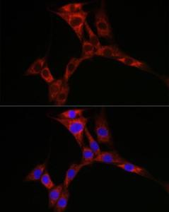 Immunofluorescence analysis of NIH/3T3 cells using Anti-PPP1R3C Antibody (A307722) at a dilution of 1:50 (40X lens). DAPI was used to stain the cell nuclei (blue)