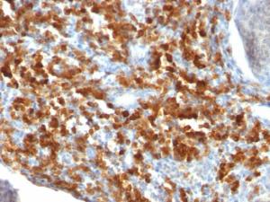 Immunohistochemical analysis of formalin-fixed, paraffin-embedded human lymphoma using Anti-CD79a Antibody [IGA/515]