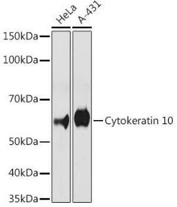 Antibody A306012-100 100 µl