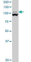 Anti-MTHFD1L Mouse Monoclonal Antibody [clone: 1E8]