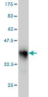 Anti-CERS4 Mouse Monoclonal Antibody [clone: 2G6]