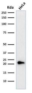 Western blot analysis of human HeLa cell lysate using Anti-p21 Antibody [CIP1/823 + DCS-60.2]