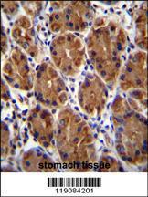 Anti-MUC3B Rabbit Polyclonal Antibody (AP (Alkaline Phosphatase))