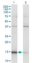 Anti-MAGOH Mouse Monoclonal Antibody [clone: 6E11]