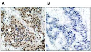 Anti-FOXO1 Rabbit Polyclonal Antibody