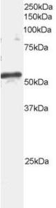 Anti-ARFGAP3 Antibody (A82800) staining (2 µg/ml) of mouse brain extracts (RIPA buffer, 35 µg total protein per lane). Primary incubated for 1 hour. Detected by western blot using chemiluminescence