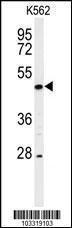 Anti-RIPK3 Rabbit Polyclonal Antibody