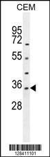 Anti-LDHAL6A Rabbit Polyclonal Antibody (HRP (Horseradish Peroxidase))