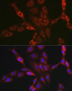 Immunofluorescence analysis of PC-12 cells using Anti-PPP1R3C Antibody (A307722) at a dilution of 1:50 (40X lens). DAPI was used to stain the cell nuclei (blue)