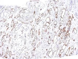 Immunohistochemical analysis of formalin-fixed, paraffin-embedded human kidney transplant using Anti-C4d Antibody [C4D204]