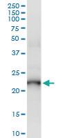 Anti-PDE4DIP Polyclonal Antibody Pair