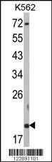 Anti-RNF5 Rabbit Polyclonal Antibody (AP (Alkaline Phosphatase))