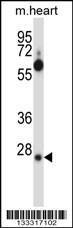 Anti-SRSF8 Rabbit Polyclonal Antibody (AP (Alkaline Phosphatase))