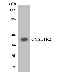 Anti-CysLT2 Rabbit Polyclonal Antibody