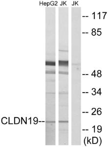 Anti-CLDN19 Rabbit Polyclonal Antibody